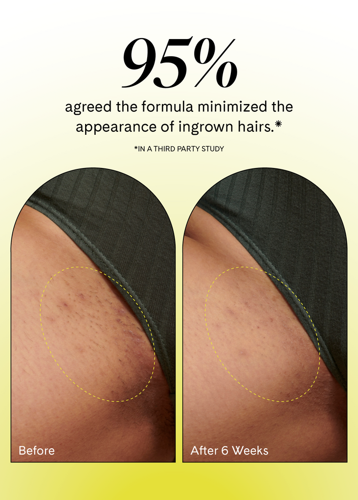 Fur Ingrown Eliminator Serum Rollerball